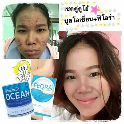 ฟีโอร่า Feora อาหารเสริมที่มาแรงที่สุด ไม่รู้จักคือพลาดอย่างแรง รูปที่ 5