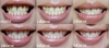 รูปย่อ ยาสีฟันสมุนไพร อะโปโล  ตัวเดียวจบ ตอบโจทย์สุขภาพปากและฟัน รูปที่3