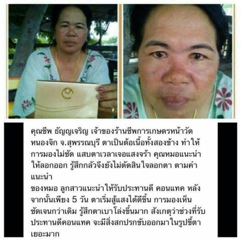 ดีคอนแทค D-contact อาหารเสริมเพื่อดวงตา ยอดขายอันดับ 1 ของเอเชีย  รูปที่ 6
