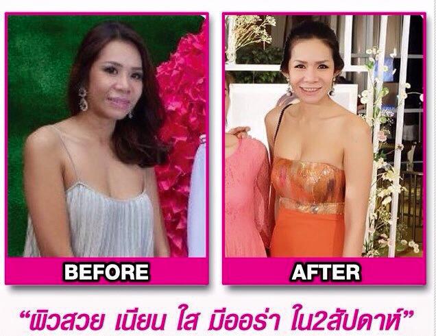 มิธ วีนัส ผลิตอาหารเสริม  0629655191  คุณยา รูปที่ 1