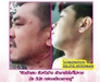 รูปย่อ มิธ วีนัส ผลิตอาหารเสริม  0629655191  คุณยา รูปที่4