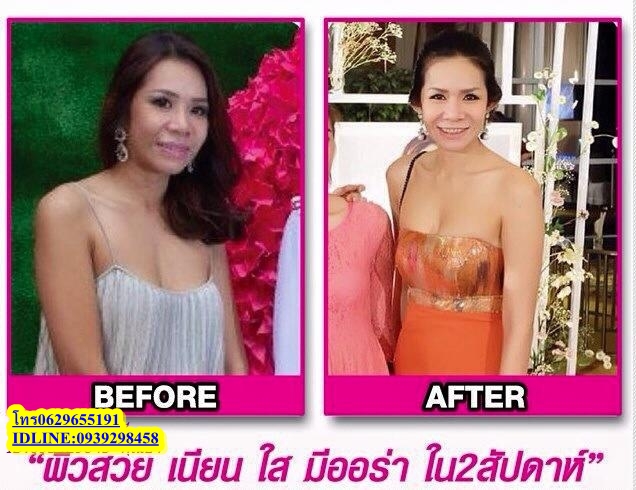 มิธ วีนัส ผลิตอาหารเสริม  0629655191  คุณยา รูปที่ 1