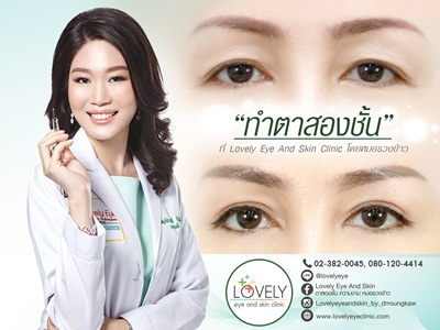 ขยายหางตา ปรับมุมหางตา (โดย Lovely Eye and Skin Clinic by Dr.Roungkaw) รูปที่ 1