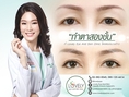 ขยายหางตา ปรับมุมหางตา (โดย Lovely Eye and Skin Clinic by Dr.Roungkaw)