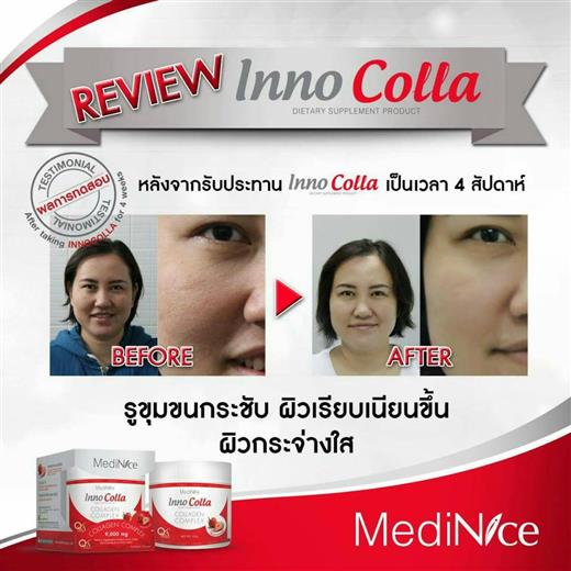MediNice Inno Colla Collagen Complex คืนความชุมชื้นให้ผิว กระชับ แลดูอ่อนกว่าวัย รูปที่ 5
