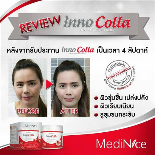 MediNice Inno Colla Collagen Complex คืนความชุมชื้นให้ผิว กระชับ แลดูอ่อนกว่าวัย รูปที่ 4