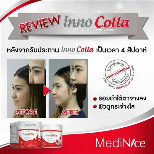 MediNice Inno Colla Collagen Complex คืนความชุมชื้นให้ผิว กระชับ แลดูอ่อนกว่าวัย รูปที่ 7