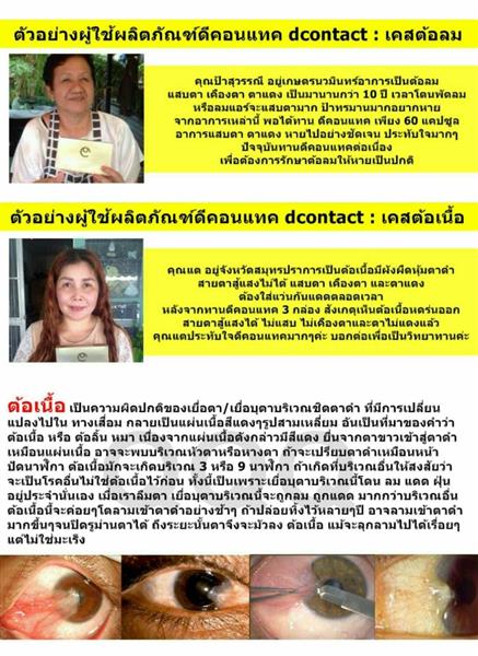 อาหารเสริม บำรุง ฟื้นฟูดวงตา ดีคอนแทค D-contact ดูแลสายตาอันดับ 1 ในประเทศ รูปที่ 7