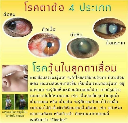 อาหารเสริมเพื่อดวงตา ดีคอนแทค D-contact ยอดขายอันดับ 1 ของเอเชีย  รูปที่ 7