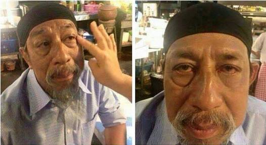 ครีมลด ริ้วรอย ใต้ตา หลุมสิว รูปที่ 5