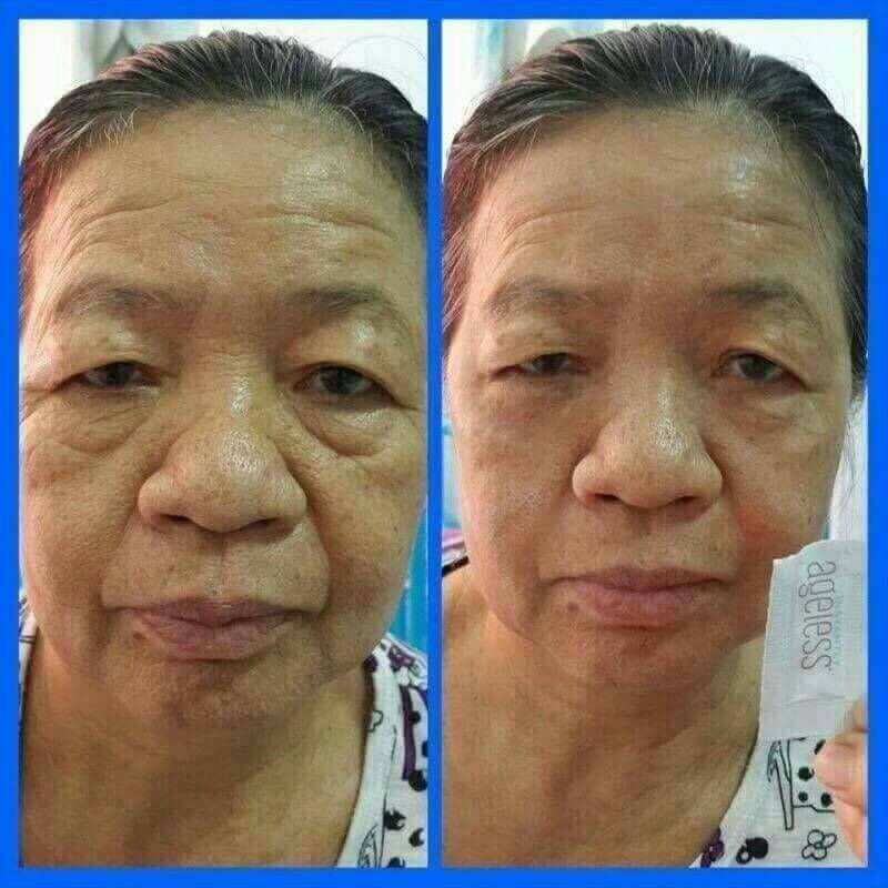 ครีมลด ริ้วรอย ใต้ตา หายภายใน 2 นาที รูปที่ 3
