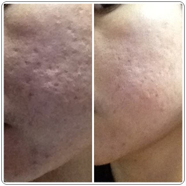 ครีมลดริ้วรอยหน้าเด็ก จากอเมริกา ผลิตภัณฑ์ของเจอเนสส์ รูปที่ 6