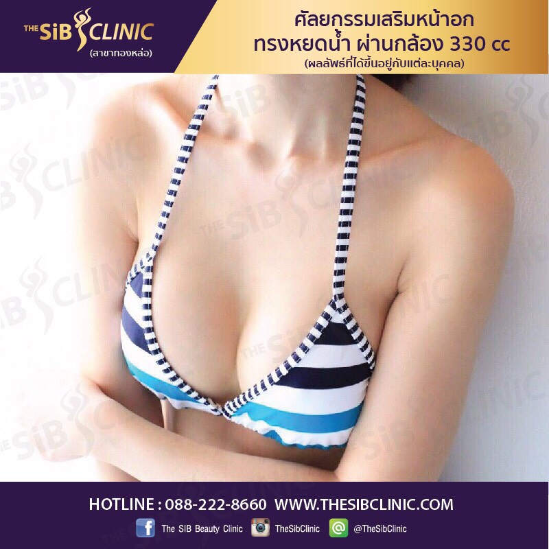 หมอดารินทร์ เสริมหน้าอก หน้าอกบาร์บี้ โทร092-4414623 หรือไอดี fonjung63 รูปที่ 1