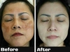 รูปย่อ Melasma Free Cream นวัตกรรมรักษา ฝ้า กระ จุดด่างดำ และลดริ้วรอย รูปที่6