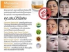 รูปย่อ Melasma Free Cream นวัตกรรมรักษา ฝ้า กระ จุดด่างดำ และลดริ้วรอย รูปที่3