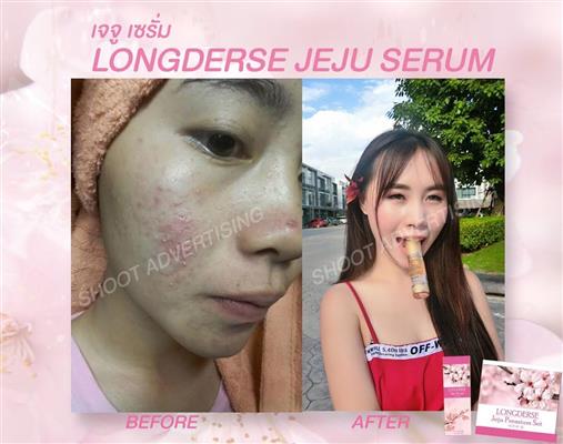 Jejuserum เจจูเซรั่ม เซรั่มที่เหมาะกับคนผิวแพ้ง่าย หน้าตึง หน้าใส หน้าเด็ก เด้ง รูปที่ 7