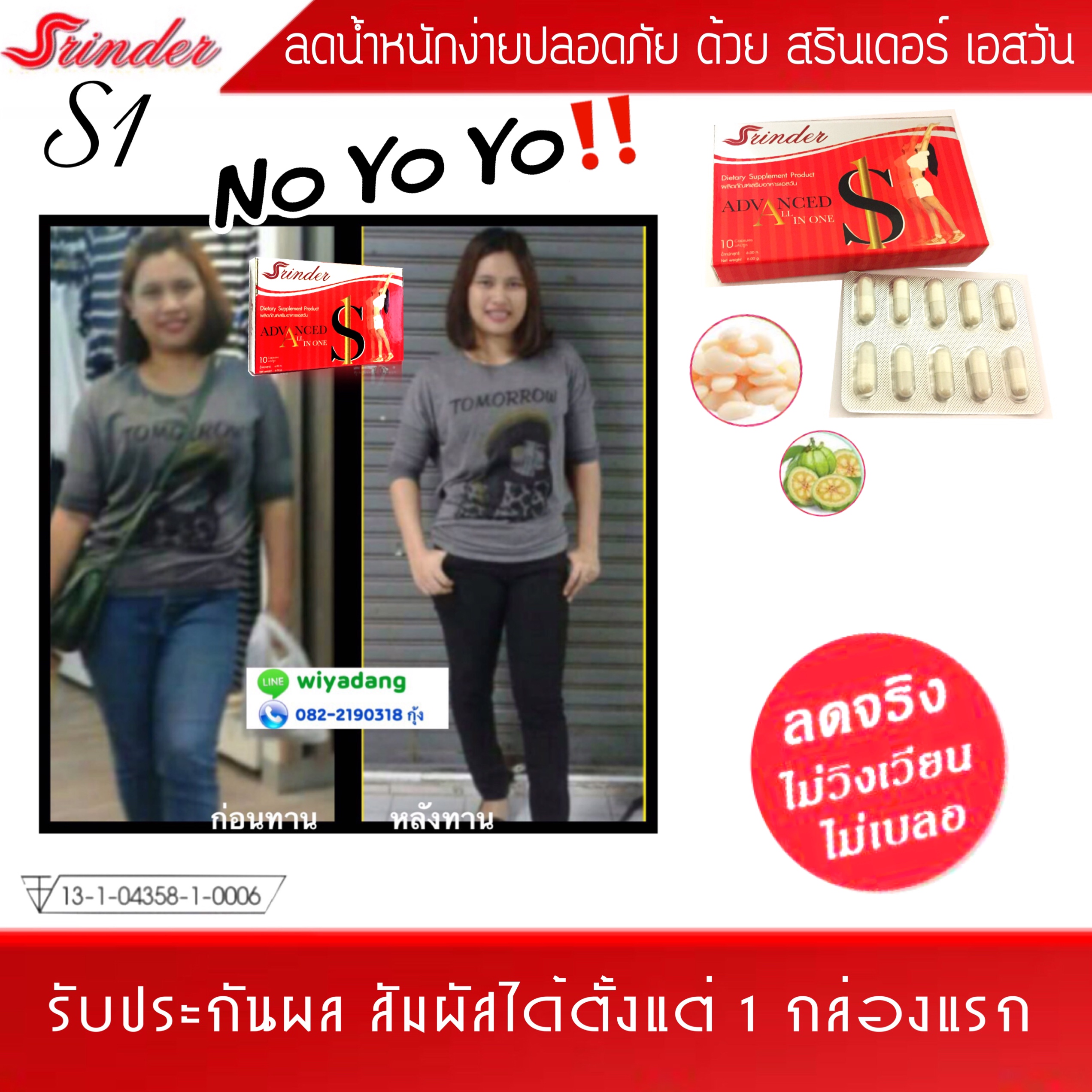 สรินเดอร์, srinder ,ลดน้ำหนัก,ลดความอ้วน รูปที่ 4