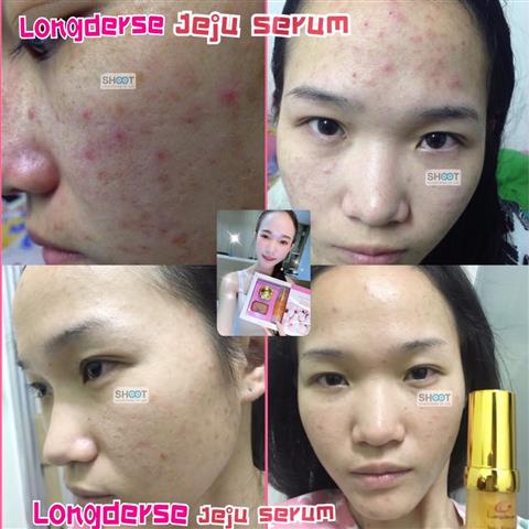 Jejuserum เจจูเซรั่ม เซรั่มที่เหมาะกับคนผิวแพ้ง่าย หน้าตึง หน้าใส หน้าเด็ก เด้ง รูปที่ 5