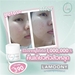 รูปย่อ Lamoony เปลี่ยนหน้าสิวเป็นสาวหน้าใส ผิวหน้าดีได้ แค่รู้จักเลือกใช้ 390 บาทก็สวยได้ รูปที่3