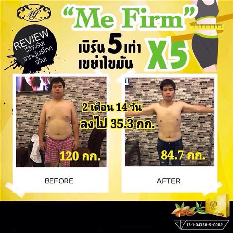 อาหารเสริม MeFirm การันตีด้วยรีวิวมากมาย ลดน้ำหนักได้จริง ไร้ปัญหาผลข้างเคียง รูปที่ 5