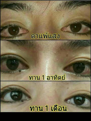 อาหารเสริมเพื่อดวงตา ดีคอนแทค D-contact  ยอดขายอันดับ 1 ของเอเชีย  รูปที่ 5