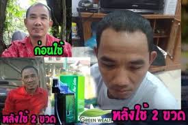 ทำไมต้องเลือกใช้เซรั่มปลูกผมนีโอแฮร์ รูปที่ 8
