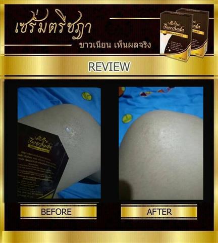 เซรั่มตรีชฎา รักแร้ขาวขึ้นใน 7 วัน ดับกลิ่น ลดเหงื่อ เห็นผลตั้งแต่ครั้งแรก รูปที่ 7