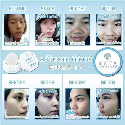 มาส์กข้าวสาเก หน้าขาวใสธรรมชาติ เพียง 1 คืน หน้าไม่โทรม แม้นอนดึก รูปที่ 5