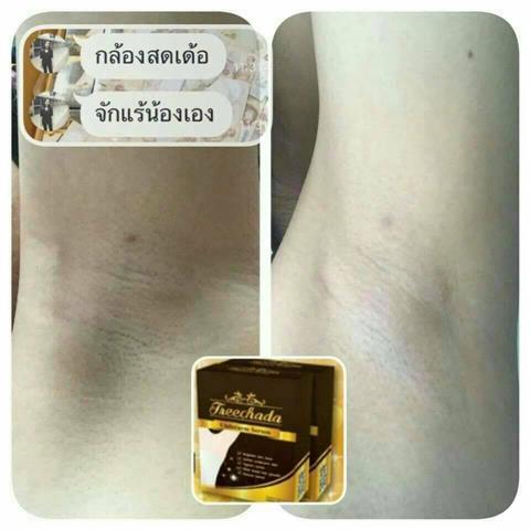 เซรั่มตรีชฎา รักแร้ขาวขึ้นใน 7 วัน ดับกลิ่น ลดเหงื่อ เห็นผลตั้งแต่ครั้งแรก รูปที่ 6