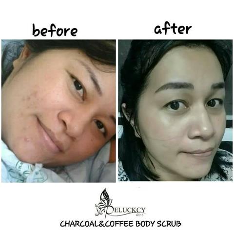 สครับชาร์โคลกาแฟ Charcoalandcoffee Body Scrub สุดยอดสครับขัดผิวจากธรรมชาติ รูปที่ 5