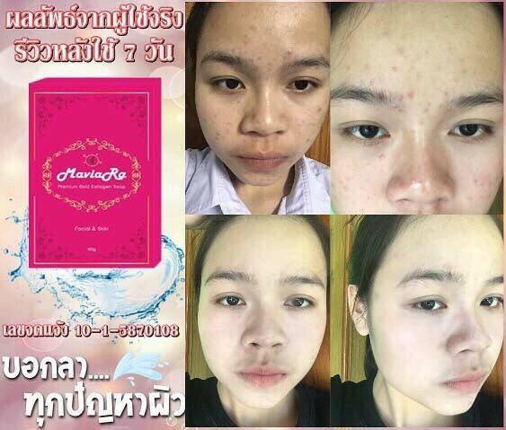 สบู่ลดสิว ลดริ้วรอย รูปที่ 6