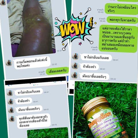 ว่านบุญรักษา คลายเส้นคลายกล้ามเนื้อ แก้ปวดข้อ ปวดกระดูก รักษากระดูก ต่อกระดูก รูปที่ 6