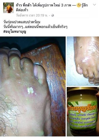 ว่านบุญรักษา คลายเส้นคลายกล้ามเนื้อ แก้ปวดข้อ ปวดกระดูก รักษากระดูก ต่อกระดูก รูปที่ 3