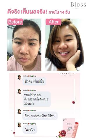 สาว Bloss #ส่งต่อความสวย บลอส เนทูร่า (Bloss Natura) ของแท้ 100% ทั้งลดทั้งแถม รูปที่ 6