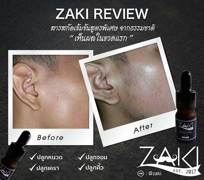 Zaki สุดยอดเซรั่มปลูกคิ้ว ปลูกหนวด สูตรเข้มเข้มข้นท้าให้ลอง รูปที่ 6