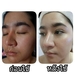 รูปย่อ Gatezy skin คอร์สหน้าใส จบทุกปัญหาผิว รูปที่5