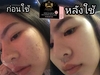 รูปย่อ Gatezy skin คอร์สหน้าใส จบทุกปัญหาผิว รูปที่4