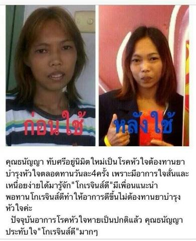 โกเรจินส์-ดี Koregins-D อาหารเสริมบำรุงสุขภาพพร้อมผิวสวยในหนึ่งเดียว รูปที่ 4