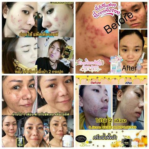 Garden me Blossom Gel การ์เด้นมี ผลิตภัณฑ์ดูแลผิวหน้าเพื่อผิวขาวใสย้อนวัย รูปที่ 6