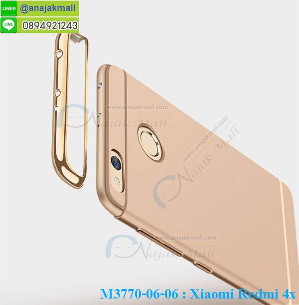 M3770 เคสประกบหัวท้าย Xiaomi Redmi 4X รูปที่ 4