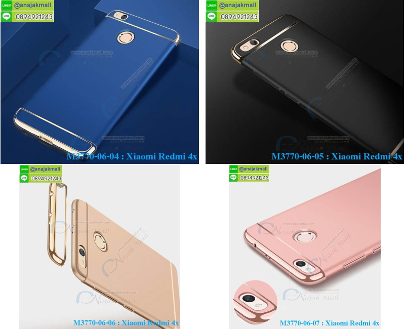 M3770 เคสประกบหัวท้าย Xiaomi Redmi 4X รูปที่ 6