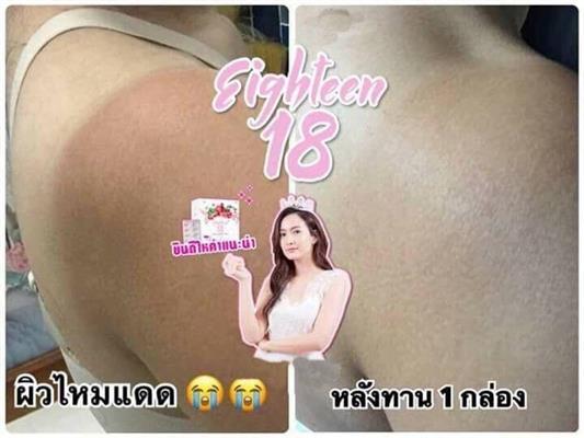 Eighteen เอธ-ธีน อาหารผิว 