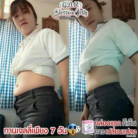 GDM Blossom gel เจลน้ำดอกไม้ และ GDM Blossom Jelly เจลลี่หุ่นสวย รูปที่ 7