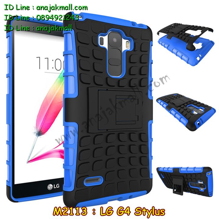 M2113 เคสทูโทนกันกระแทก LG G4 Stylus รูปที่ 3