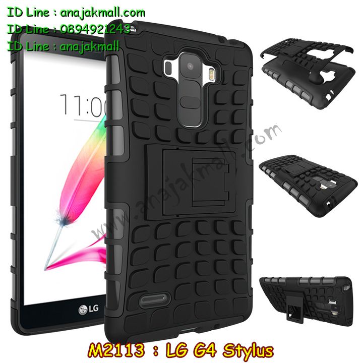 M2113 เคสทูโทนกันกระแทก LG G4 Stylus รูปที่ 4