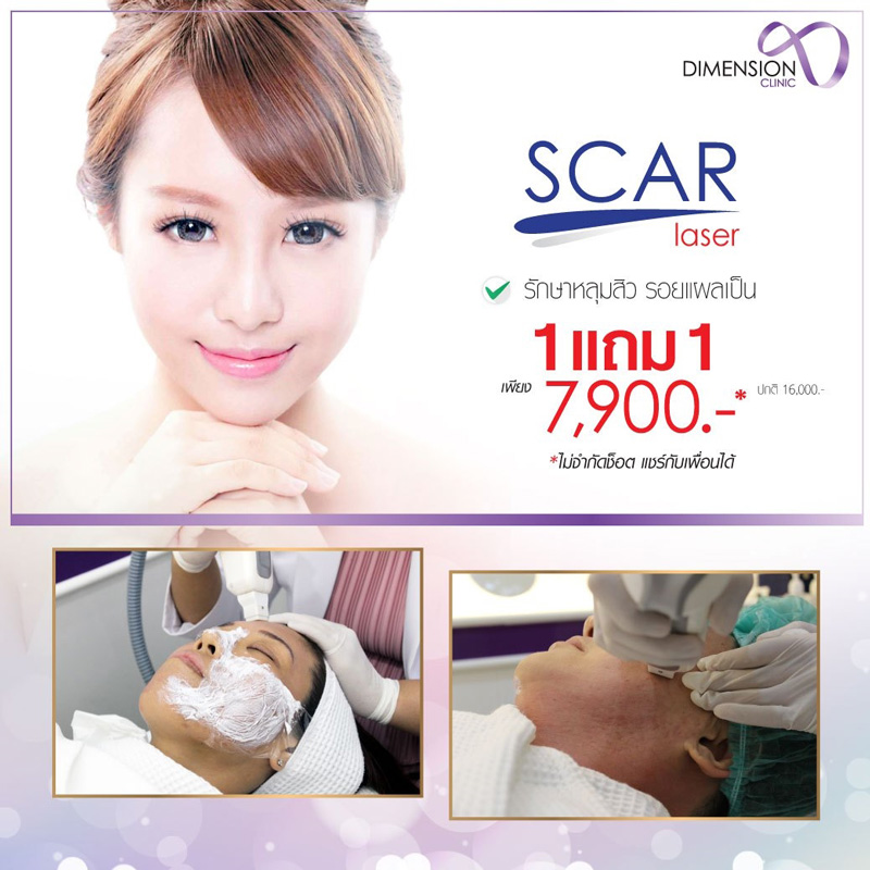 คลินิกรักษาหลุมสิว ย่านทองหล่อ ดูแลโดยคุณหมอ รอยแผลจากหลุมสิวตื้นขึ้นจริงๆคะ รูปที่ 4