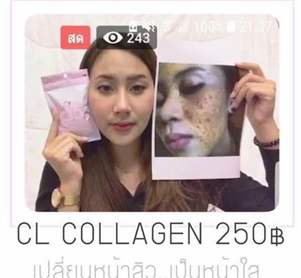 CL Collagen สวยครบจบในซองเดียว จบปัญหาสิว ฝ้า กระ จุดด่างดำ หลุมสิว รูปที่ 6