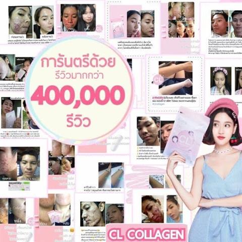 CL Collagen สวยครบจบในซองเดียว จบปัญหาสิว ฝ้า กระ จุดด่างดำ หลุมสิว รูปที่ 4