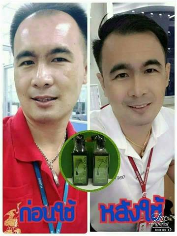 NEOHAIR LOTION ทุกปัญหาของเส้นผมจะหมดไป รูปที่ 7