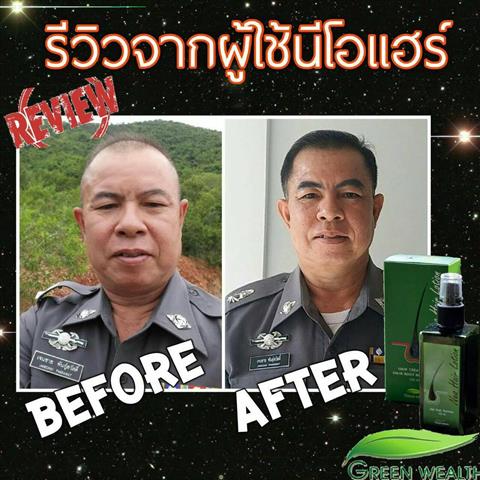 NEOHAIR LOTION ทุกปัญหาของเส้นผมจะหมดไป รูปที่ 6